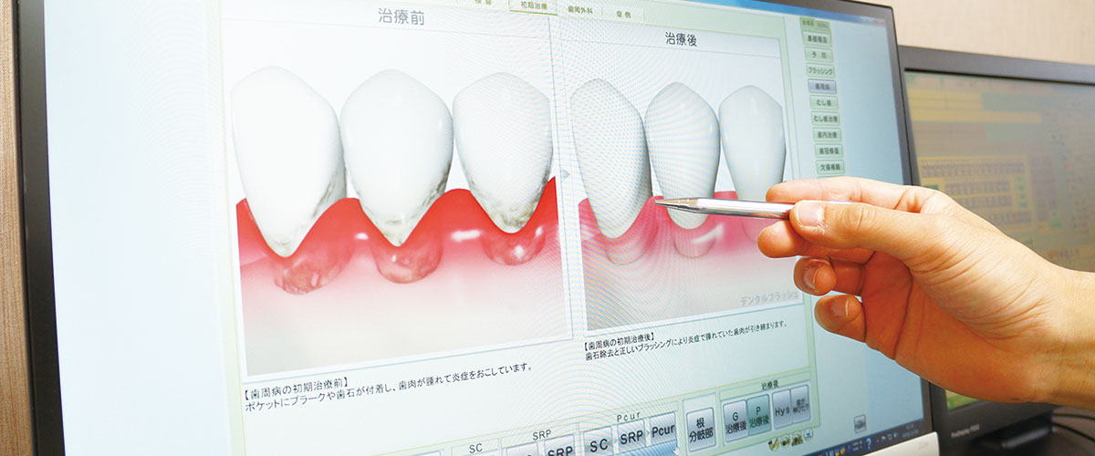 成田歯科・矯正歯科医院の矯正歯科