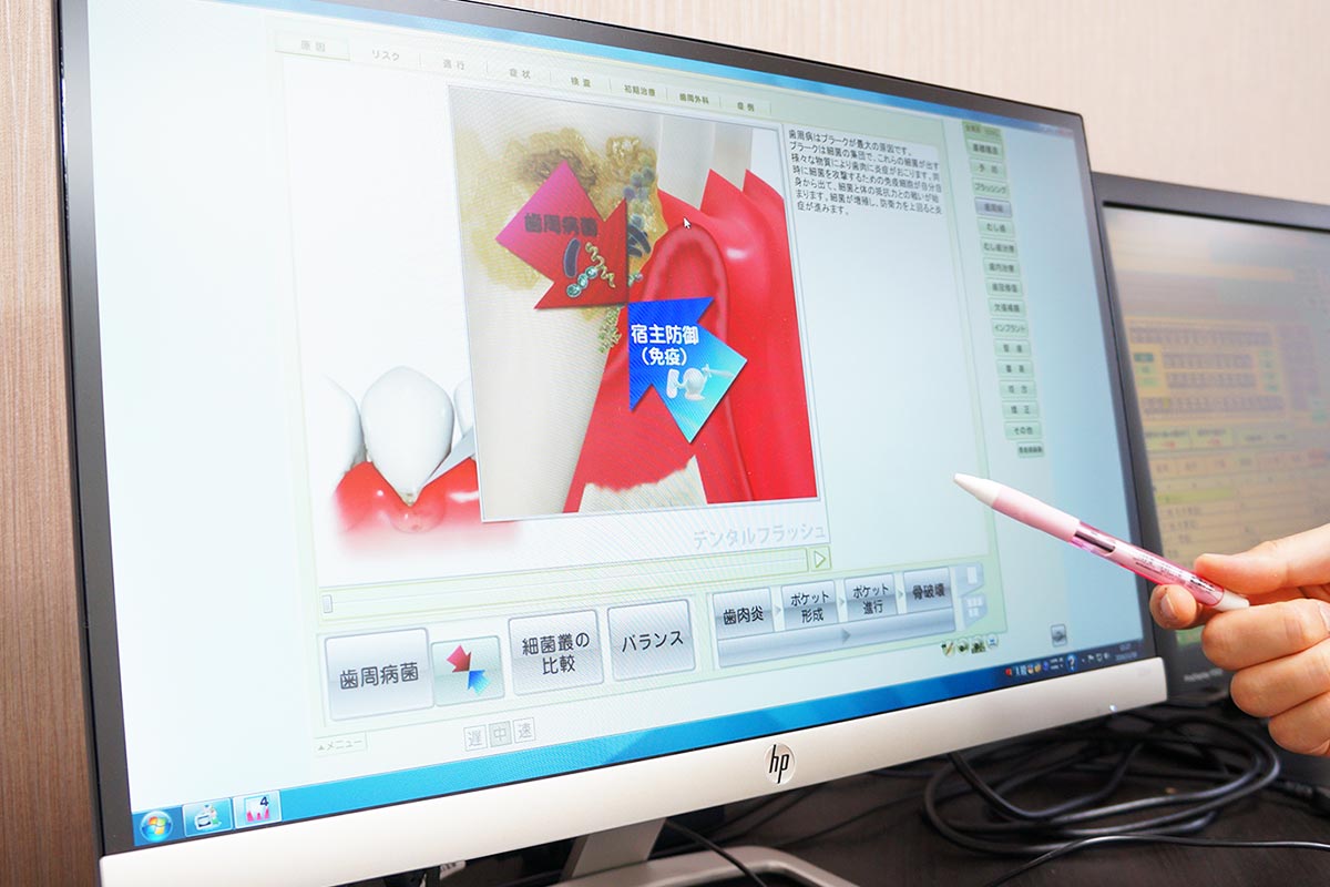 歯周病治療計画