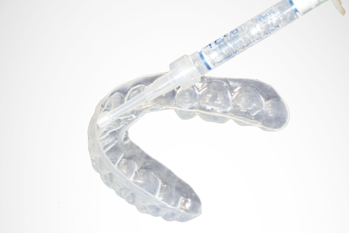 ホワイトニング